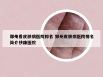 郑州看皮肤病医院排名 郑州皮肤病医院排名简介肤康医院