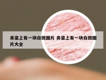 鼻梁上有一块白斑图片 鼻梁上有一块白斑图片大全