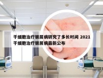 干细胞治疗银屑病研究了多长时间 2021干细胞治疗银屑病最新公布