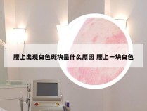 腰上出现白色斑块是什么原因 腰上一块白色