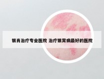 银肖治疗专业医院 治疗银霄病最好的医院