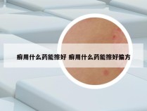 癣用什么药能擦好 癣用什么药能擦好偏方