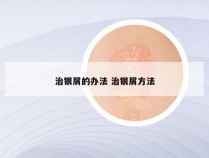 治银屑的办法 治银屑方法