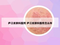 庐江皮肤科医院 庐江皮肤科医院怎么样