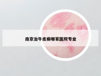 南京治牛皮癣哪家医院专业