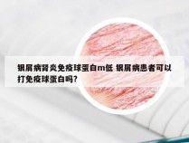 银屑病肾炎免疫球蛋白m低 银屑病患者可以打免疫球蛋白吗?