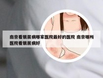 南京看银屑病哪家医院最好的医院 南京哪所医院看银屑病好