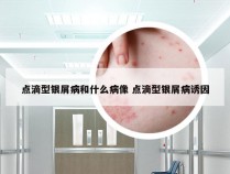 点滴型银屑病和什么病像 点滴型银屑病诱因