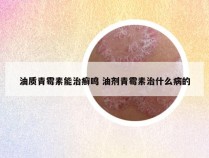 油质青霉素能治癣鸣 油剂青霉素治什么病的