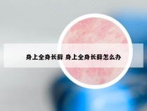 身上全身长藓 身上全身长藓怎么办