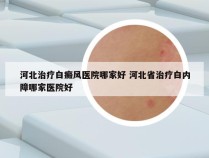 河北治疗白癜风医院哪家好 河北省治疗白内障哪家医院好