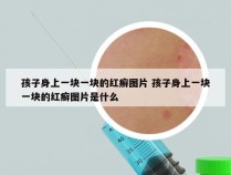 孩子身上一块一块的红癣图片 孩子身上一块一块的红癣图片是什么