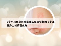 6岁小孩身上长癣是什么原因引起的 6岁儿童身上长癣怎么办