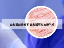 盐和醋能治癣不 盐和醋可以治脚气吗