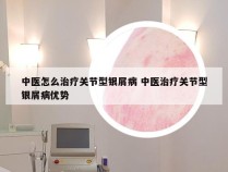 中医怎么治疗关节型银屑病 中医治疗关节型银屑病优势