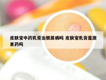 皮肤宝中药乳膏治银屑病吗 皮肤宝乳膏是激素药吗