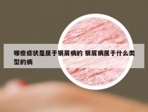 哪些症状是属于银屑病的 银屑病属于什么类型的病