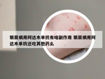 银屑病用阿达木单抗有啥副作用 银屑病用阿达木单抗还吃其他药么