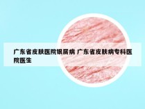 广东省皮肤医院银屑病 广东省皮肤病专科医院医生