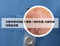 大腿外侧对称起了像癣一样的东西 大腿外侧对称起疙瘩