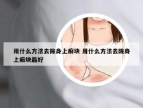 用什么方法去除身上癣块 用什么方法去除身上癣块最好