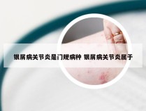 银屑病关节炎是门规病种 银屑病关节炎属于