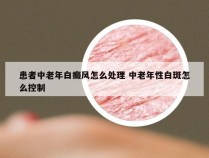 患者中老年白癜风怎么处理 中老年性白斑怎么控制