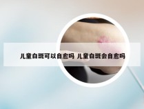 儿童白斑可以自愈吗 儿童白斑会自愈吗