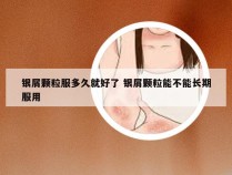 银屑颗粒服多久就好了 银屑颗粒能不能长期服用