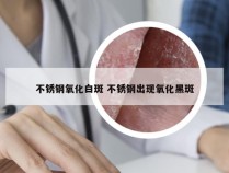 不锈钢氧化白斑 不锈钢出现氧化黑斑