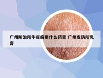 广州防治所牛皮癣用什么药膏 广州皮防所乳膏