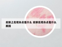 皮肤上出现白点是什么 皮肤出现白点是什么原因