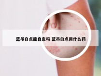 蓝吊白点能自愈吗 蓝吊白点用什么药