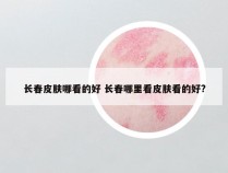 长春皮肤哪看的好 长春哪里看皮肤看的好?