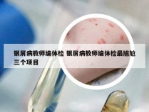 银屑病教师编体检 银屑病教师编体检最尴尬三个项目