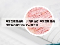 寻常型银屑病用什么药物治疗 寻常型银屑病用什么药最好360个人图书馆