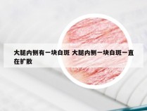 大腿内侧有一块白斑 大腿内侧一块白斑一直在扩散