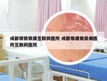 成都银销银康互联网医院 成都银康银屑病医院互联网医院