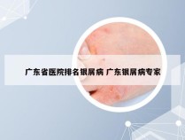 广东省医院排名银屑病 广东银屑病专家