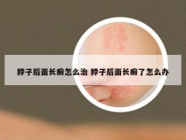 脖子后面长癣怎么治 脖子后面长癣了怎么办