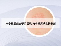 南宁银屑病去哪家医院 南宁银屑病生物制剂