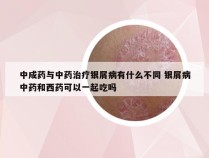 中成药与中药治疗银屑病有什么不同 银屑病中药和西药可以一起吃吗