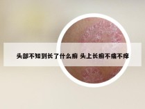 头部不知到长了什么癣 头上长癣不痛不痒