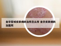 金华婺城皮肤病防治院怎么样 金华皮肤病防治医院