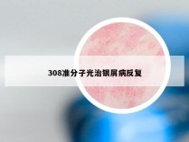 308准分子光治银屑病反复