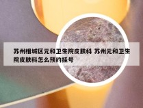 苏州相城区元和卫生院皮肤科 苏州元和卫生院皮肤科怎么预约挂号