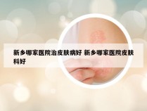 新乡哪家医院治皮肤病好 新乡哪家医院皮肤科好