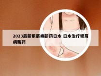 2023最新银屑病新药日本 日本治疗银屑病新药