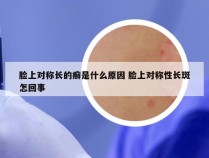 脸上对称长的癣是什么原因 脸上对称性长斑怎回事