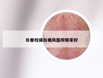 长春权威白癜风医院哪家好